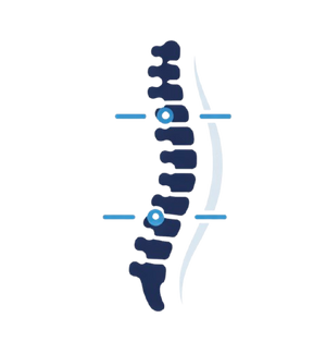 Better Spinal Alignment